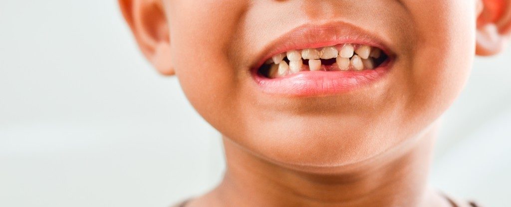 Little boy with missing teeth